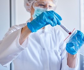 Informazioni sulla PCR e sul test rapido dell'antigene a maggio