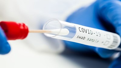 [SIJEČANJ 2022.] Informacije o PCR i brzim antigenskim testiranjima